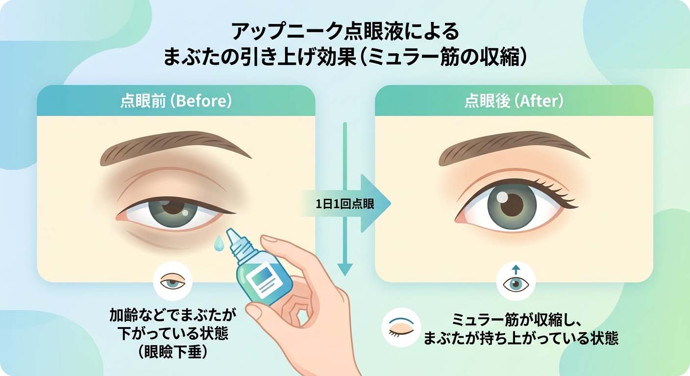 アップニーク点眼液によるまぶたの引き上げ効果